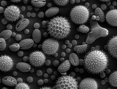 pollen-electron-microscope-allergy-causing.jpg